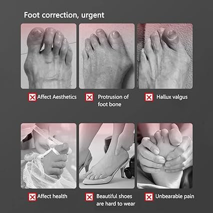 New Toe straightener