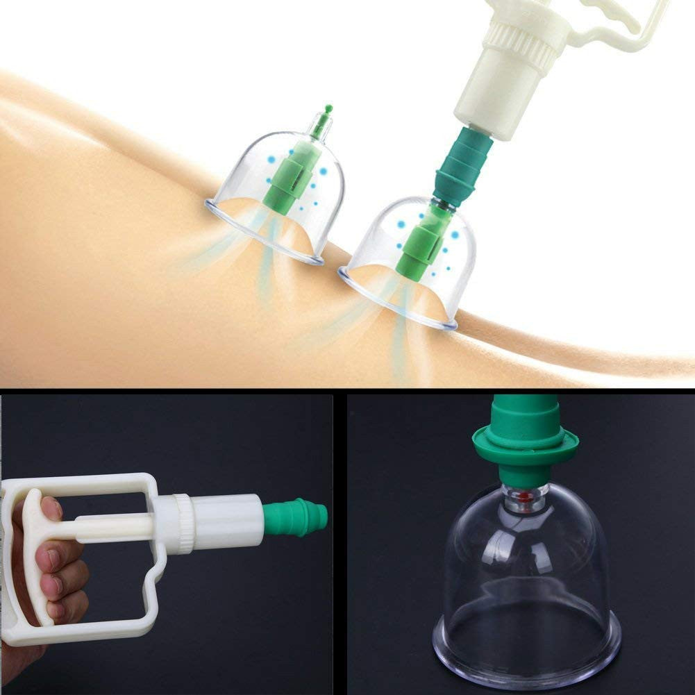12 PIS SET VACUUM ACUPUNCTURE CUPPING