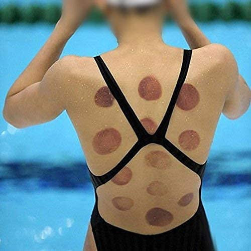 12 PIS SET VACUUM ACUPUNCTURE CUPPING