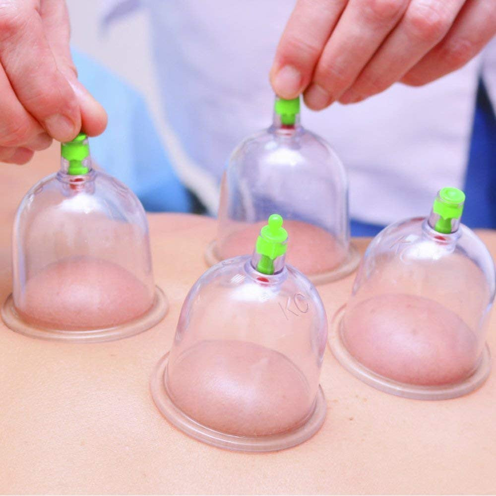 12 PIS SET VACUUM ACUPUNCTURE CUPPING