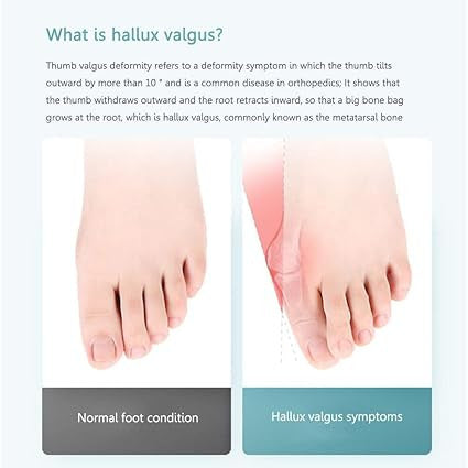 New Toe straightener